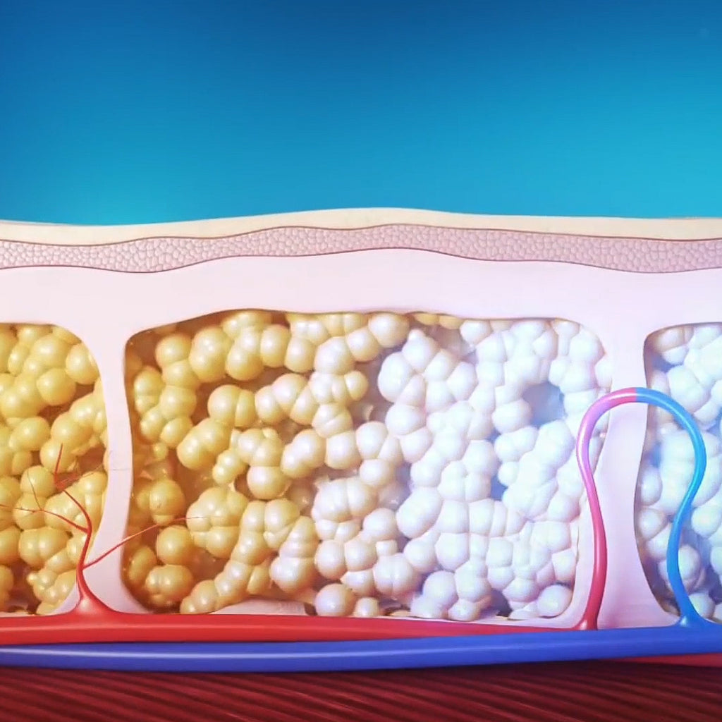 Kriolipoliza + elektrostymulacja mięśni EMS Cryo Basic - metoda działania