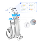 Kriolipoliza CoolGlamor 360° - lewy bok