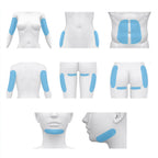 Kriolipoliza CoolGlamor 360° - obszary zabiegowe