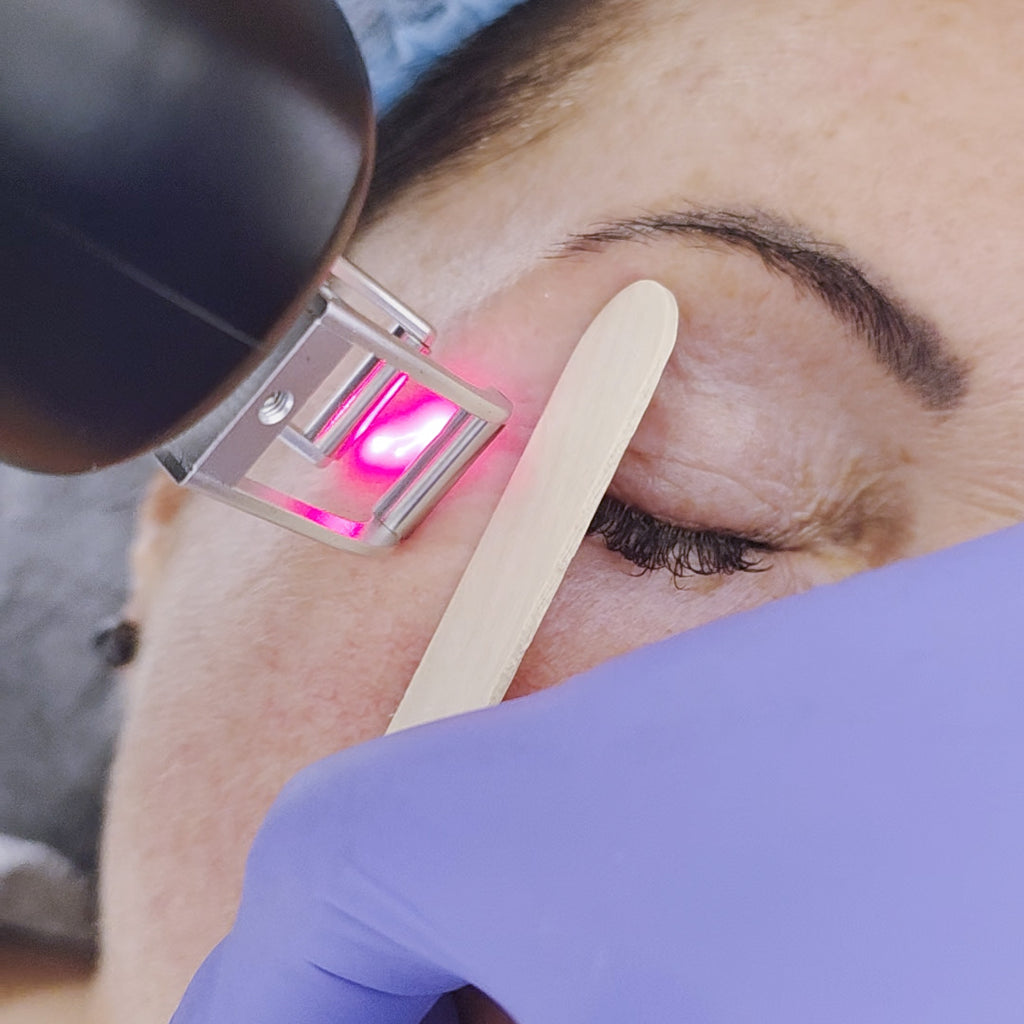 Laser Tulowy 1920 nm Thalia - praca na powiece