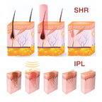 SHR IPL E-light - schemat działania